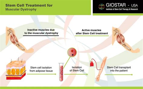 Muscular Dystrophy Stem Cell Treatment - Captions Pages