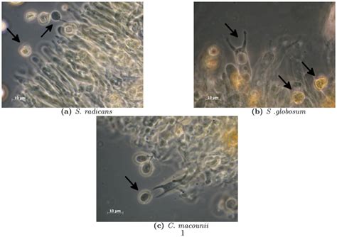 Microscope images of hymenium structures. Hymenium structures in 3% KOH ...