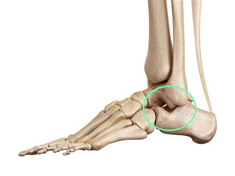 Sinus Tarsi Syndrome: A Comprehensive Guide - Sport Doctor London