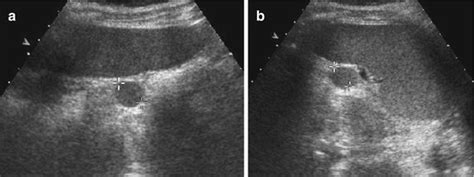 Spleen and Pancreas | Radiology Key