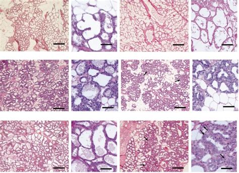 Histology of mammary glands of hyperthyroid and control lactating rats ...