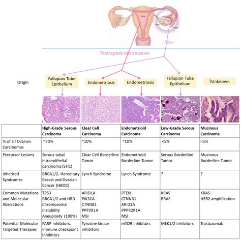 Unveiling Ovarian Cancer: Decoding Elevated Tumor Markers – Coach M Morris