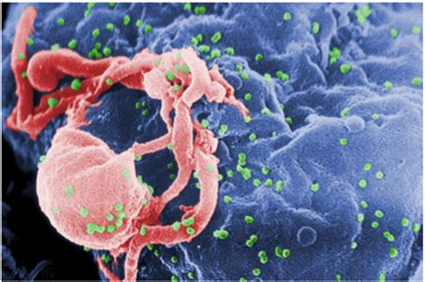 Acute Retroviral Syndrome In The ED — NUEM Blog