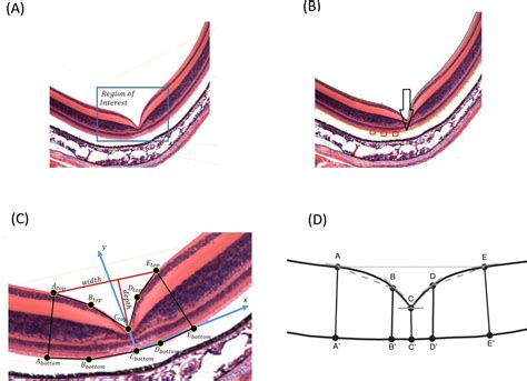 Fovea Histology