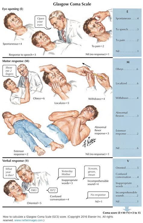 How to Calculate a Glasgow Coma Scale... - Manual of Medicine