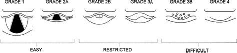 Cormack and Lehane classification and new classification of view at ...