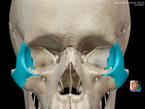 High cheekbones are caused by prominent zygomatic...