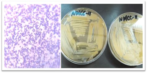 Gram-Positive Pediococcus under a light microscope that was obtained ...