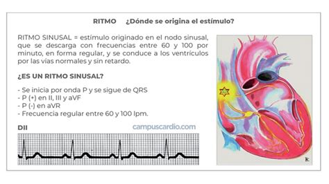 Características del ritmo Sinusal - CampusCardio