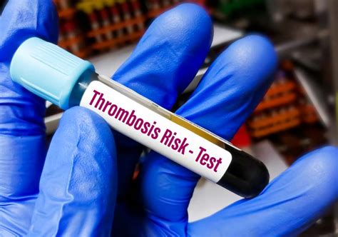 Thrombosis | ClinCaseQuest