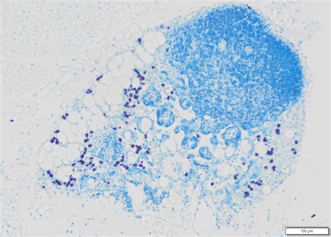 Stains for mast cells |Toluidine Blue Stain Kit