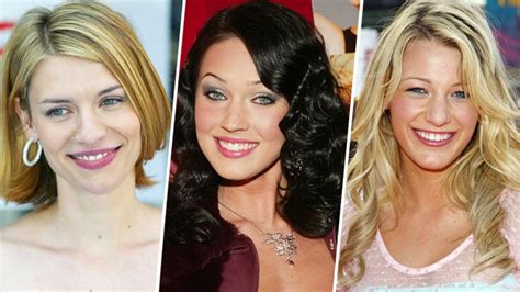 Celebrity Cosmetic Transformations: Before and After Stories | by ...