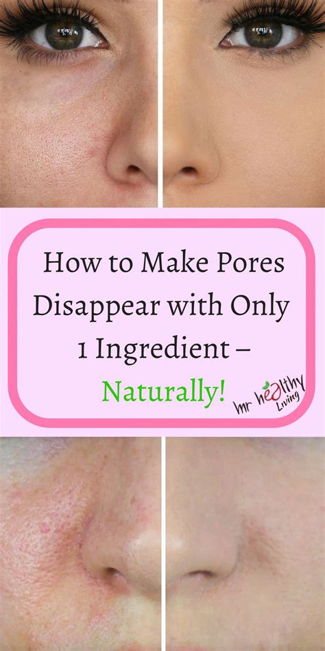 open pores + open pores on face + open pores on face how to get rid ...