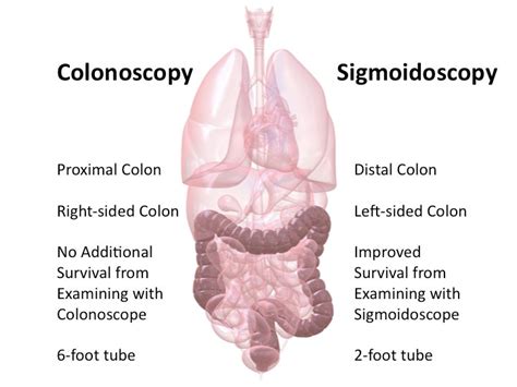 McDougall Newsletter: August 2010 - Colon Cancer