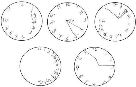 [PDF] Automatic interpretation of clock drawings for computerised ...