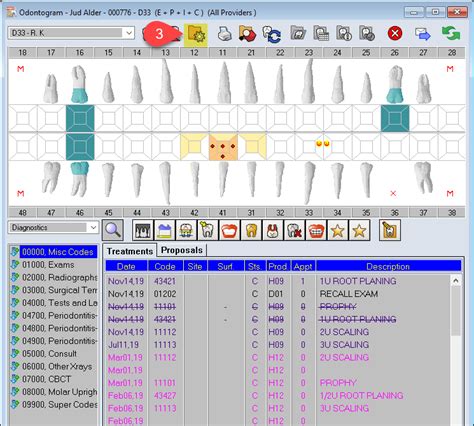 Setting up the Odontogram - Power Practice