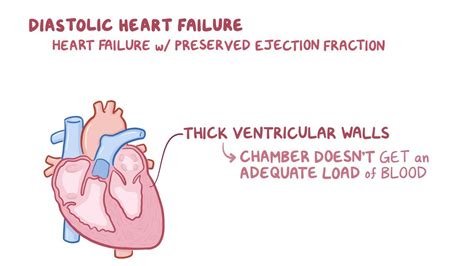 Heart failure: Clinical: Video, Anatomy & Definition | Osmosis