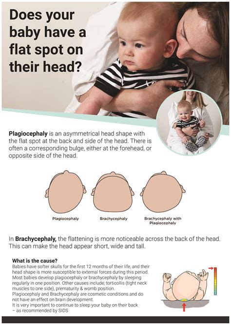 Assessment and evaluation for baby's flat head plagiocephaly