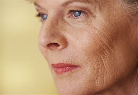 Wrinkles :: Unique Cosmetic Clinic