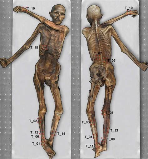 Ancient ink: Iceman Otzi has the world's oldest tattoos | Smithsonian ...