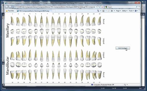 Odontogram Control Demo Part 2 - YouTube