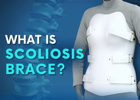 Scoliosis Braces: Can Scoliosis be Corrected with a Brace? - Turan&Turan