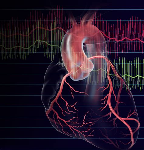 FFR and iFR used to Evaluate Coronary Stenosis | Clark Medical Illustration