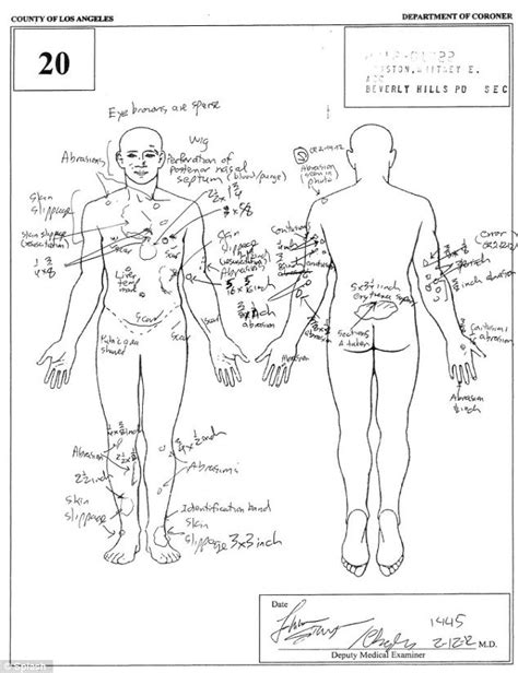 Whitney Houston autopsy report revealed the sordid end of the superstar