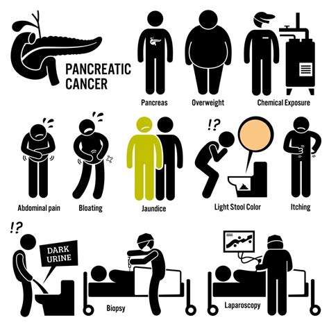 10 Symptoms of Pancreatic Cancer - Facty Health