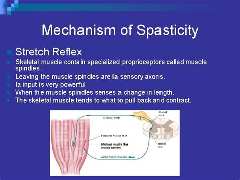 Spasticity What Causes it and Can it be