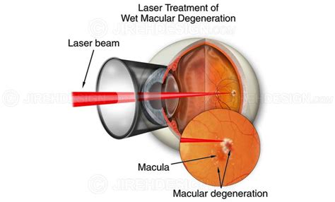 Kommunikationsnetzwerk Vermuten Reduktor Brunnen Trog Erbse macular ...