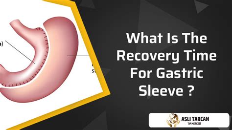 What Is The Recovery Time For Gastric Sleeve