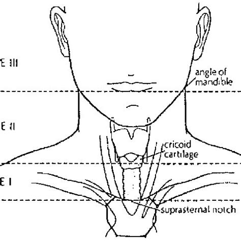 Definition of the three anatomic zones used in neck trauma (from ...