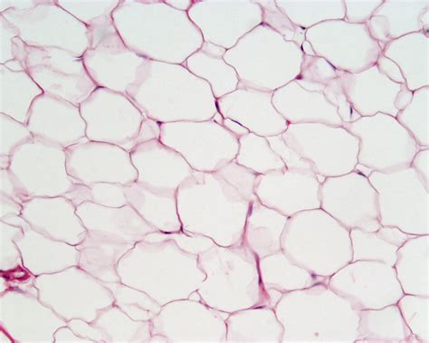 Kinds of Connective Tissue - Notes for Pakistan