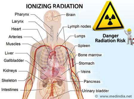 Radiation Hazard