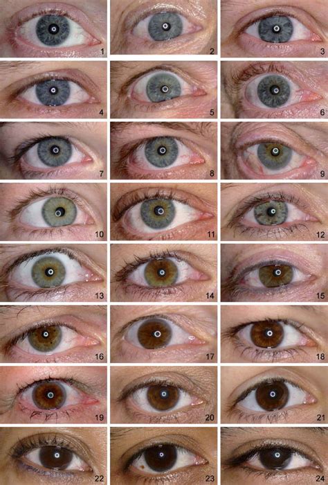 Grading of Iris Color with an Extended Photographic Reference Set ...