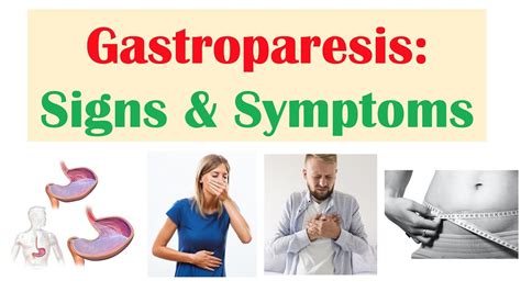 Gastroparesis Signs & Symptoms (ex. Nausea, Abdominal Pain, Weight Loss ...