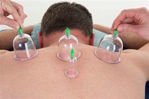 Instrument Assisted Soft Tissue Mobilization | Cupping | College Station