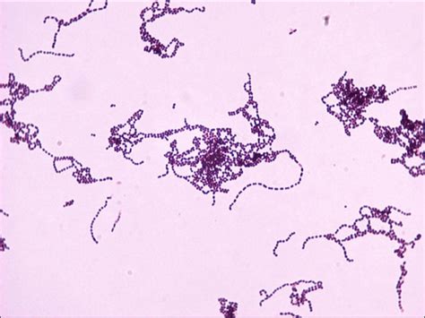 Streptococcus Salivarius Gram Stain