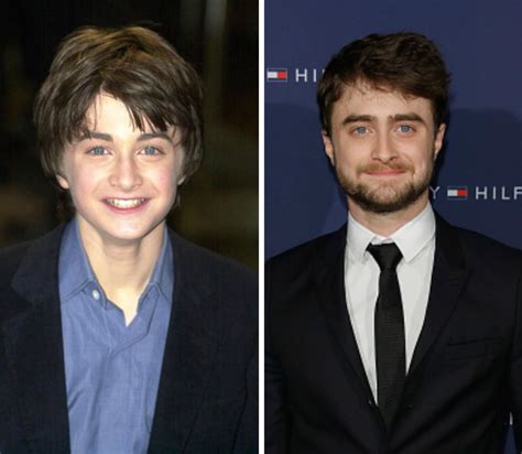 A Look Back: The Evolution Of The Harry Potter Cast Over Time.