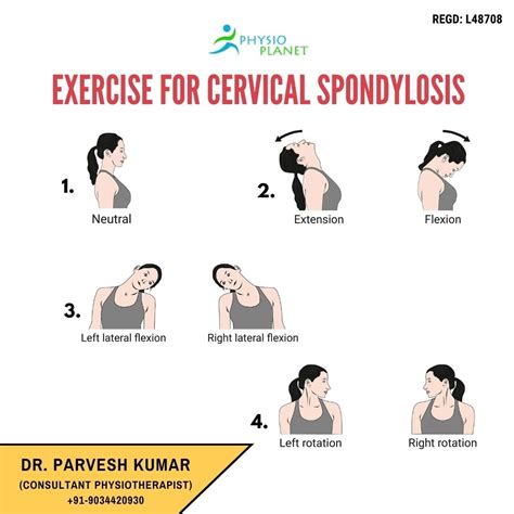 Cervical Spondylosis Physiotherapy Exercises