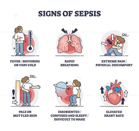 Signs of sepsis as infection blood poisoning symptoms outline ...