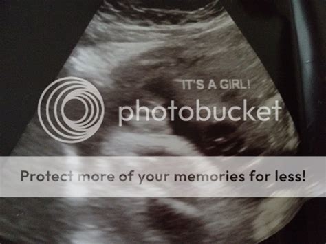 Good girl pics from 30 week ultrasound? - BabyCenter