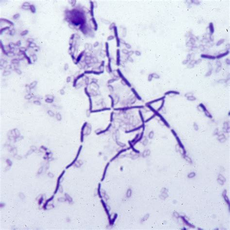 Morphology Of Bacillus Subtilis