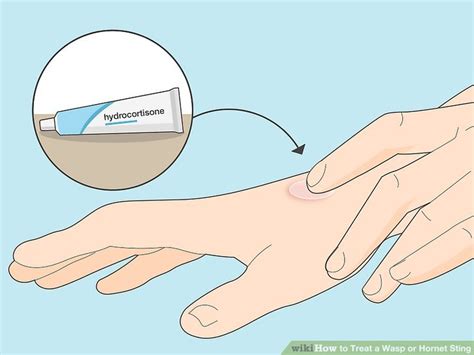 3 Ways to Treat a Wasp or Hornet Sting - wikiHow