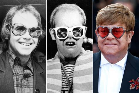 So What’s the Deal With Elton John’s Hair?