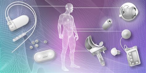 Smart implants making major impact in the medical world