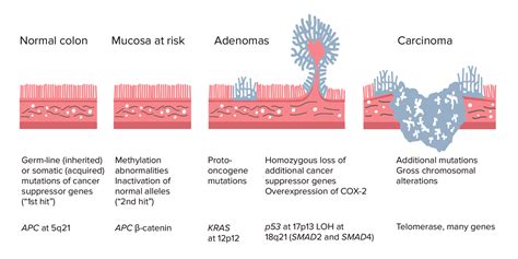 Tubular Adenoma Colon Polyp