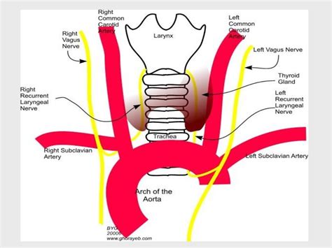 Recurrent laryngeal nerve paralysis