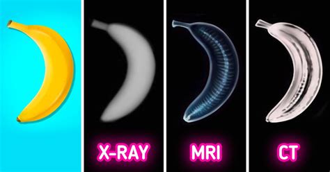 X-Rays, MRI Scans and CT Scans: What’s t... | Shield HealthCare